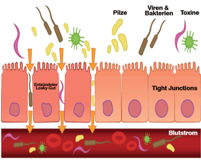 Darmschleimhaut, Leaky Gut